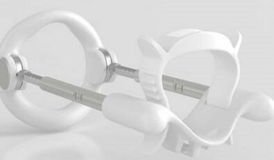 Extender adds members